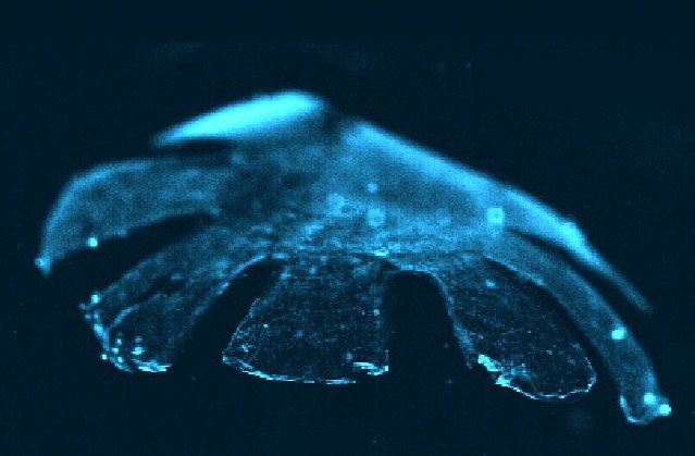 Bioengineered "medusoid" jellyfish