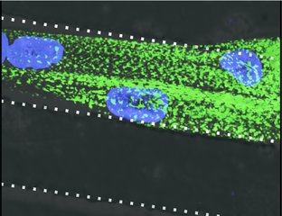 Engineered human muscle tissue