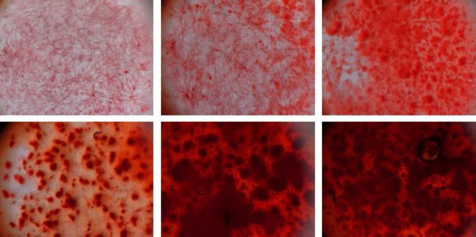 Layered clay particles cause stem cells to become bone cells, as revealed by the formation of bone matrix (in red).