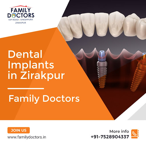 familydoctors – Dental Implants in Zirakpur